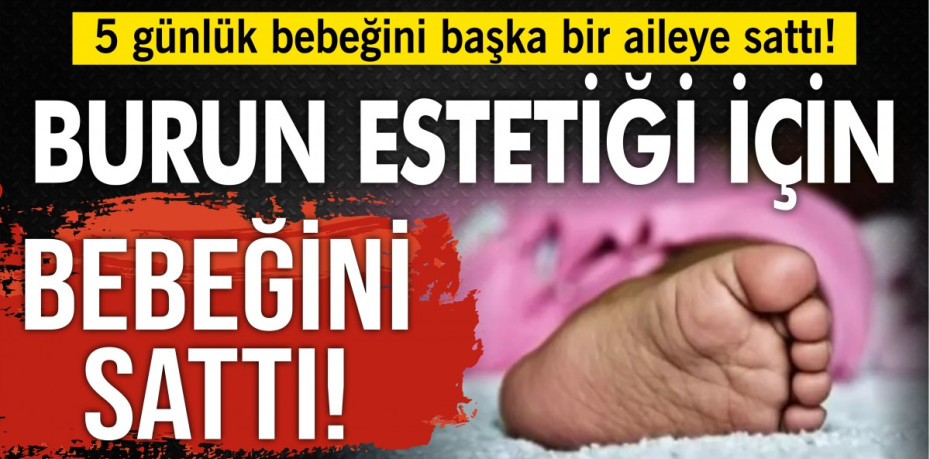 BURUN ESTETİĞİ İÇİN BEBEĞİNİ SATTI...