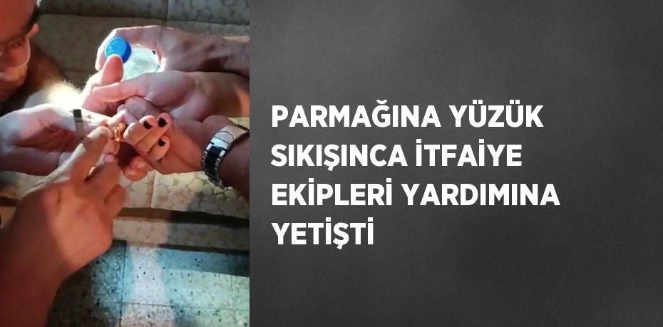 PARMAĞINA YÜZÜK SIKIŞINCA İTFAİYE EKİPLERİ YARDIMINA YETİŞTİ